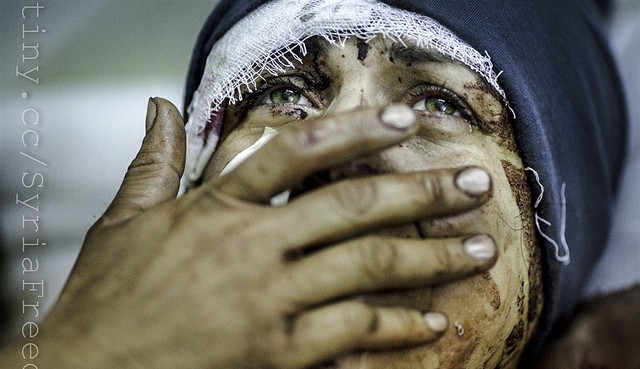 injured syrian woman